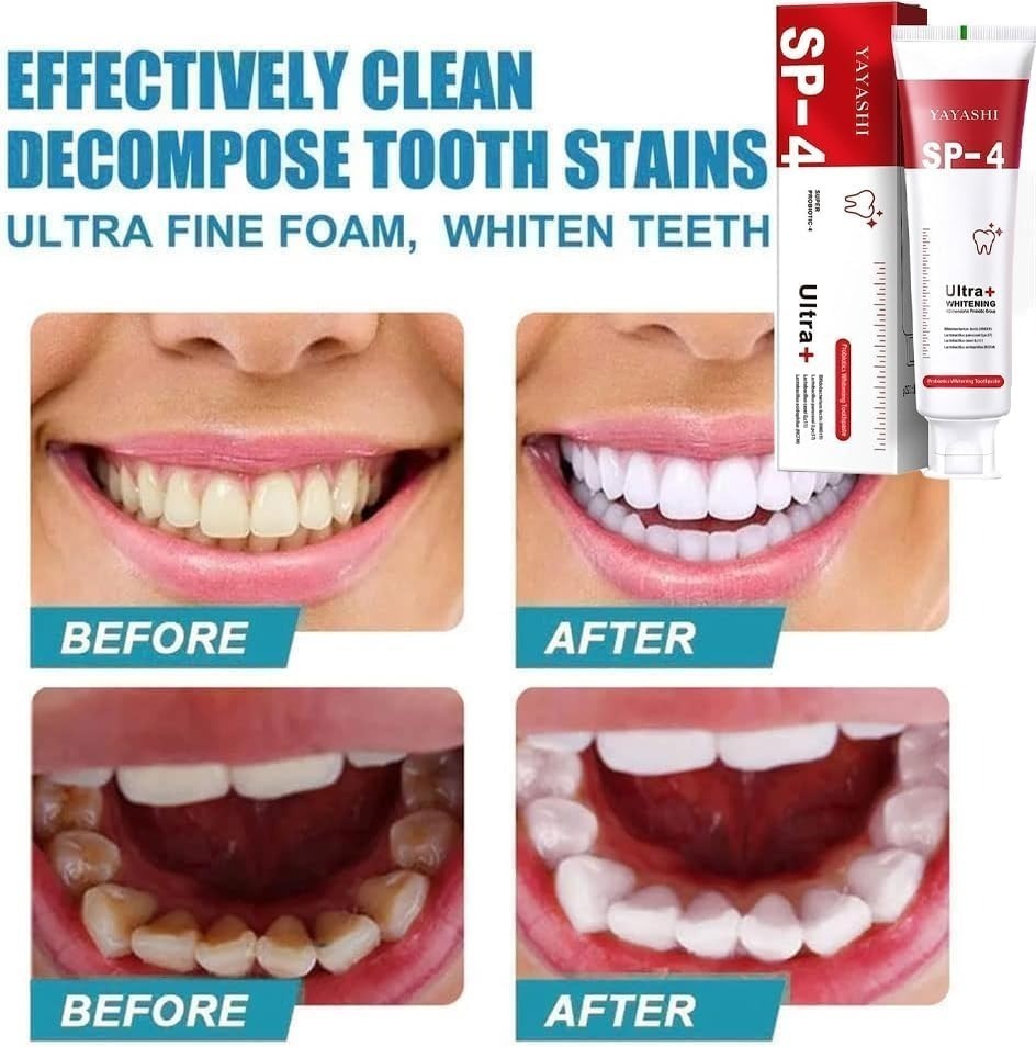 YAYASHI SP-4 Ultra Whitening Probiotic Toothpaste